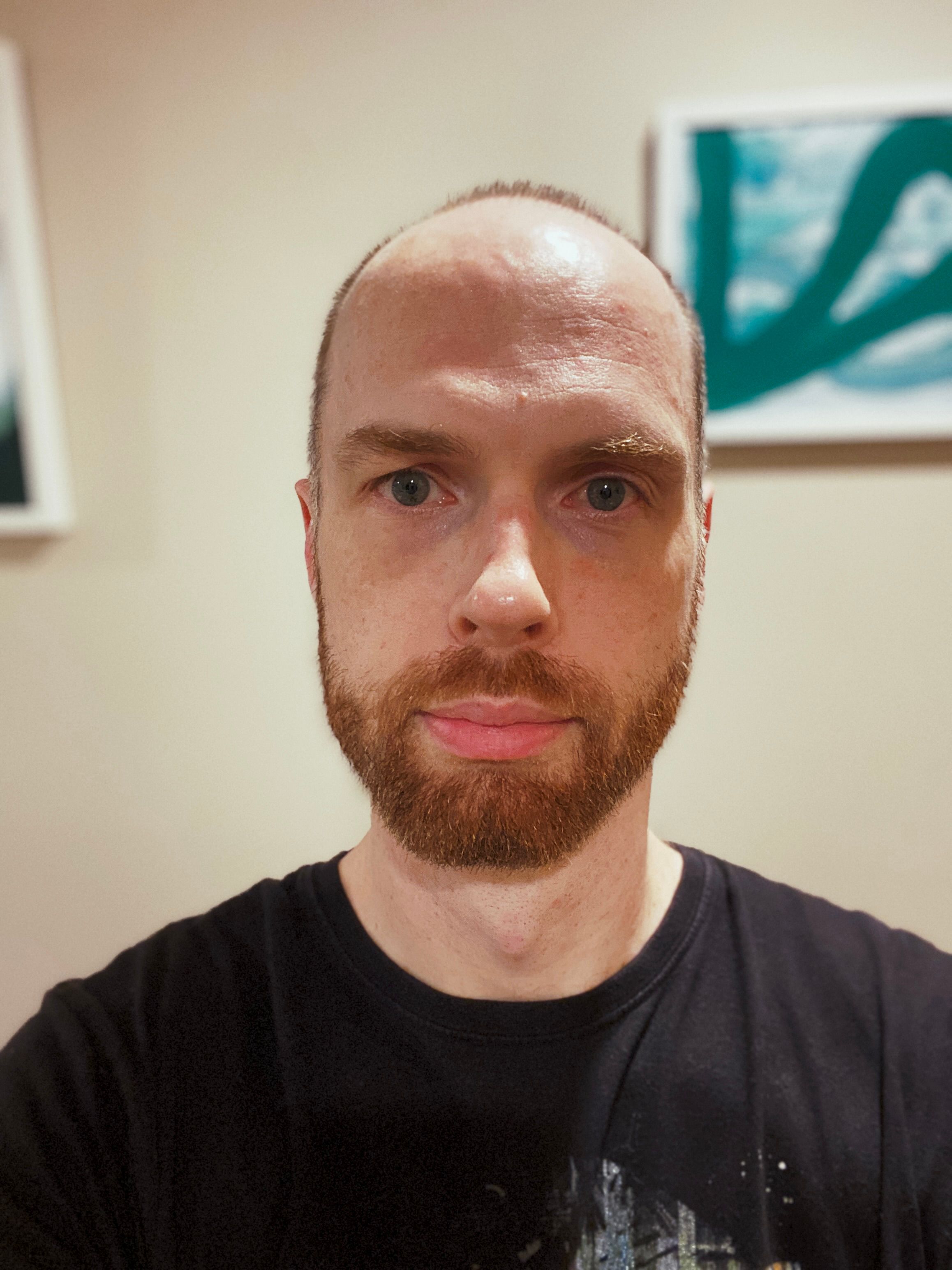 Me again, but this time the hair and beard have been gone over with a #2 razor attachment and it's all wonderfully short and neat.